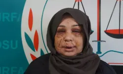 Polis Eşten Şiddet: Kadın Hayatından Endişeli