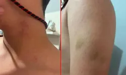 Ortaokulda Öğretmen Öğrencisini Darbetti İddiası; Aile Şikâyetçi Oldu