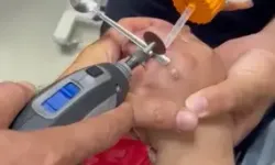 Parmağına Sıkışan Yüzüğü İtfaiye Çıkardı