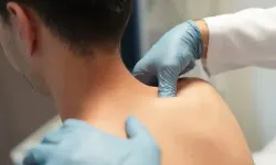 Klima Ve Stres Kulunç Ağrısını Tetikleyebiliyor
