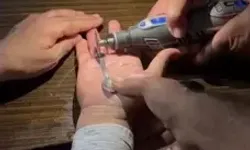 Parmaklarına Sıkışan Yüzükleri İtfaiye Çıkardı
