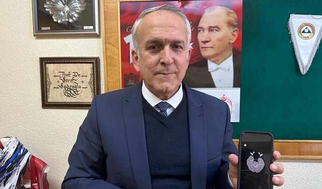 Tümör Tespit Eden 'Yapay Zeka Algoritması'na Yurt Dışından Talep