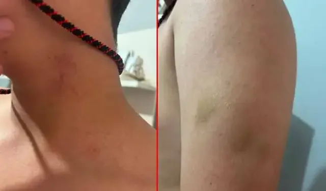 Ortaokulda Öğretmen Öğrencisini Darbetti İddiası; Aile Şikâyetçi Oldu