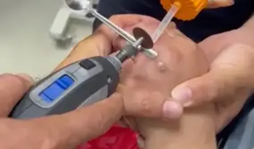 Parmağına Sıkışan Yüzüğü İtfaiye Çıkardı